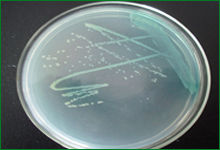 铜绿假单胞菌在普通培养基上的培养特性