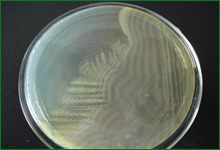 奇异变形杆菌在普通培养基上的生长特性